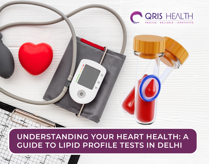 Lipid Profile Tests in Delhi